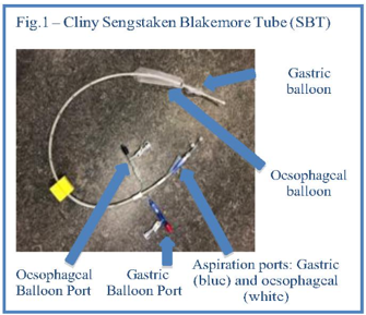 Figure 1 -  Photo of a Cliny Sengstaken Blakemore Tube